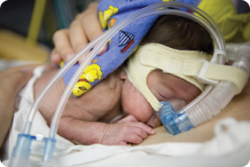 baby ventilation mechanical premature cpap preemie reporting expert financial analysis positive pressure